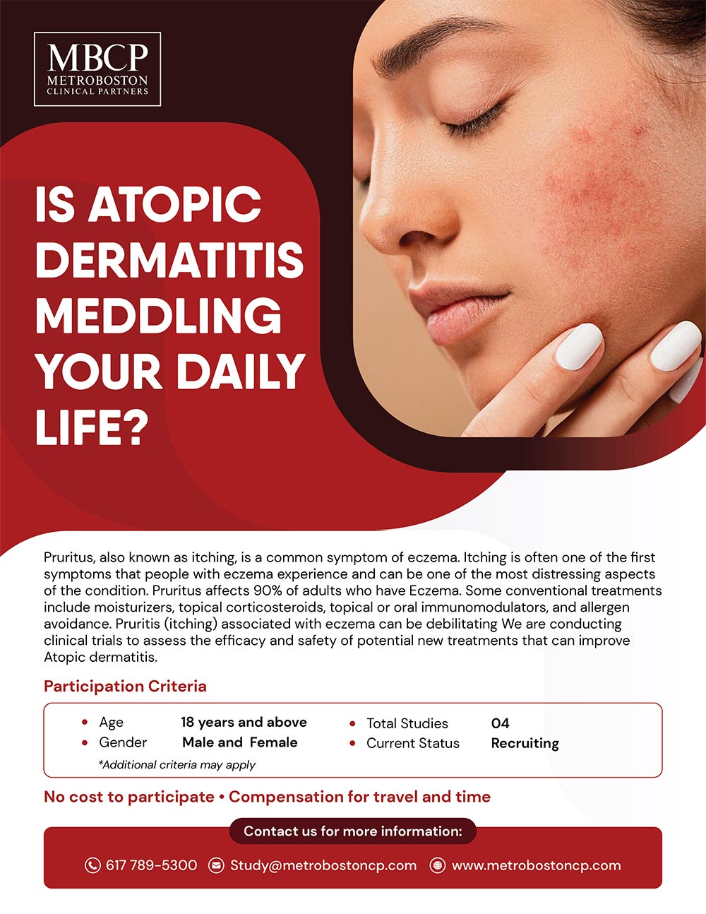 Dermatology Clinical Trials in Boston - Atopic Dermatitis Clinical Trials in Boston