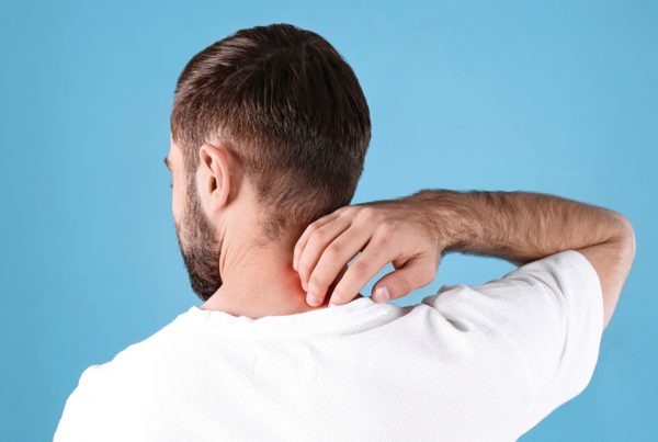 Eczema On Back Of Neck
