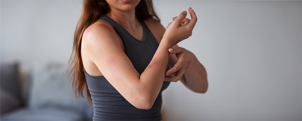 Asteatotic Eczema Symptoms Causes And Treatment