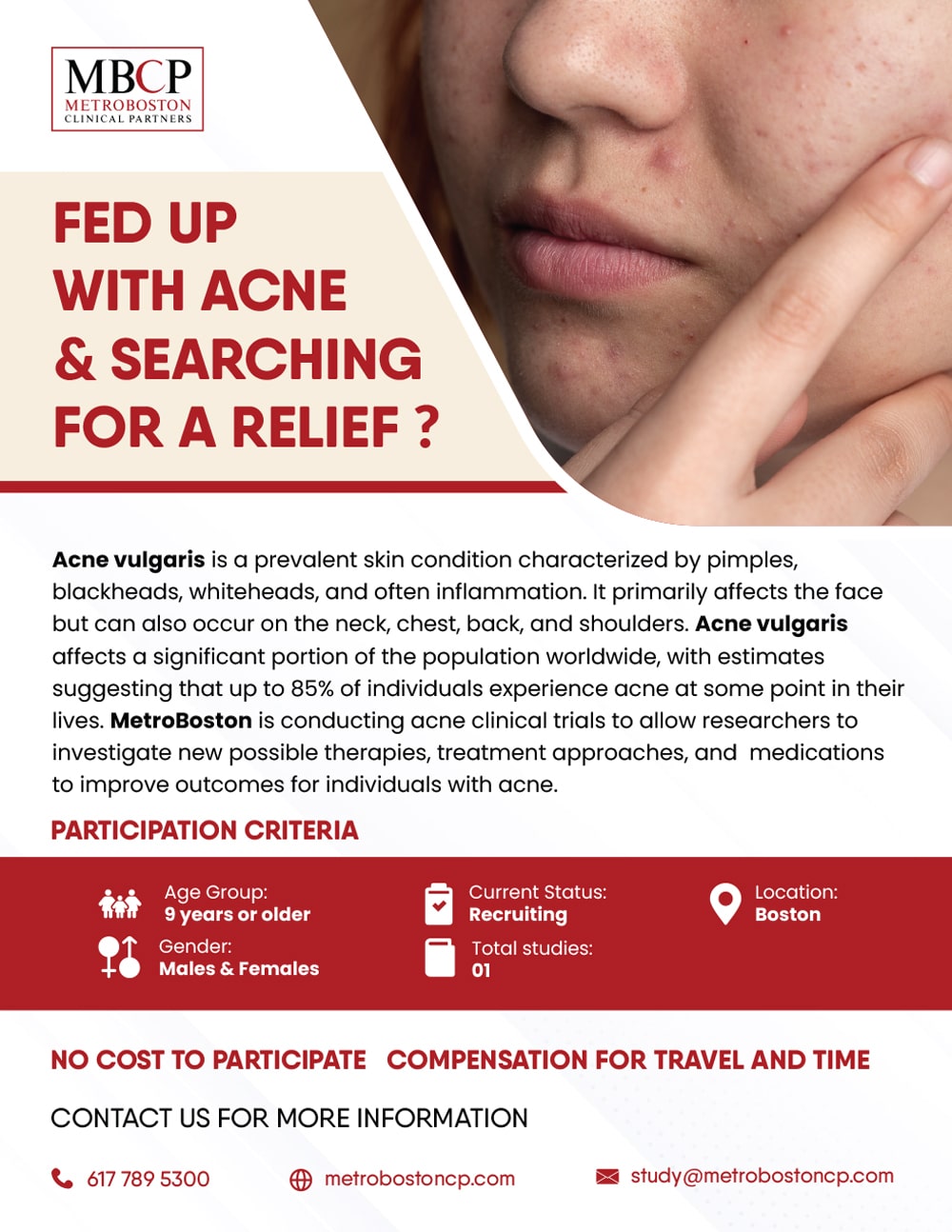 Acne Flyer