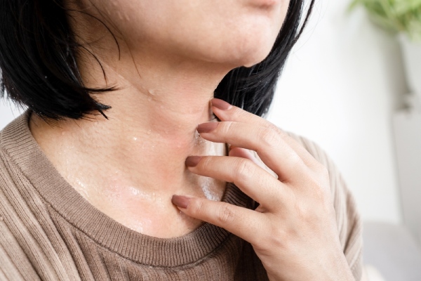 sweaty-neck-causing-cholinergic-urticaria
