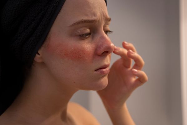 is-lupus-hereditary-or-genetic